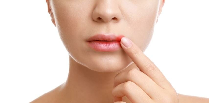 Cold Sores Vs Canker Sores How To Spot The Difference Mybuyingtips